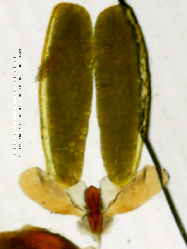 01A04-acicular02c.jpg
